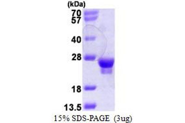 RAB18 Protein (AA 1-206) (His tag)