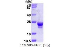 SDS-PAGE (SDS) image for RAB18, Member RAS Oncogene Family (RAB18) (AA 1-206) protein (His tag) (ABIN667980)