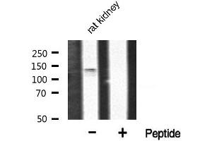 Western blot analysis of FGFR1 phosphorylation expression in rat kidney tissue lysates,The lane on the right is treated with the antigen-specific peptide. (FGFR1 antibody  (pTyr766))