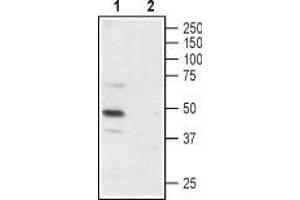 Western blot analysis of rat DRG: - 1. (P2X3 Receptor (AA 65-79), (Extracellular) antibody)
