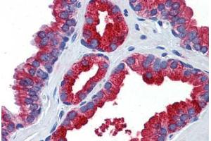 Human Prostate: Formalin-Fixed, Paraffin-Embedded (FFPE) (Klotho antibody  (AA 720-769))