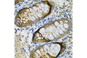 Immunohistochemistry of paraffin-embedded human colon using SELENBP1 Antibody (ABIN5970564) at dilution of 1/100 (40x lens). (SELENBP1 antibody)