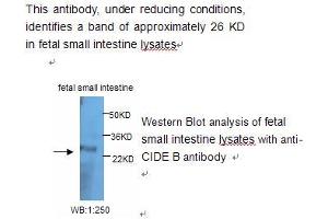 Image no. 1 for anti-Cell Death-Inducing DFFA-Like Effector B (CIDEB) antibody (ABIN790841) (CIDEB antibody)