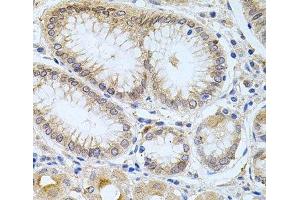 Immunohistochemistry of paraffin-embedded Human stomach using CPM Polyclonal Antibody at dilution of 1:100 (40x lens). (CPM antibody)