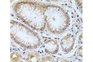 Immunohistochemistry of paraffin-embedded Human stomach using CPM Polyclonal Antibody at dilution of 1:100 (40x lens).