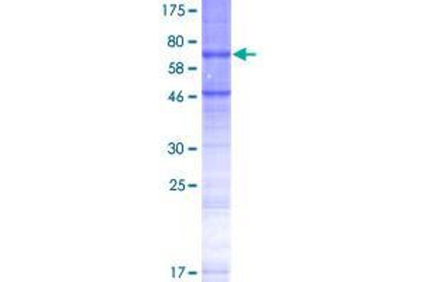 STEAP2 Protein (AA 1-490) (GST tag)