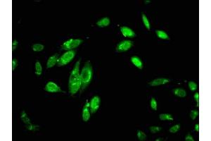 Immunofluorescent analysis of Hela cells using ABIN7148353 at dilution of 1:100 and Alexa Fluor 488-congugated AffiniPure Goat Anti-Rabbit IgG(H+L) (C1R antibody  (AA 65-192))
