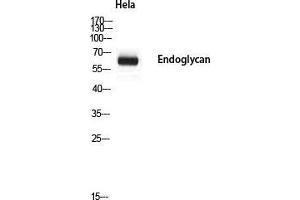 Western Blot (WB) analysis of HeLa using Endoglycan antibody. (PODXL2 antibody)