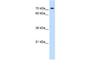 SLC5A11 antibody used at 1 ug/ml to detect target protein. (Solute Carrier Family 5 (Sodium/inositol Cotransporter), Member 11 (SLC5A11) antibody)