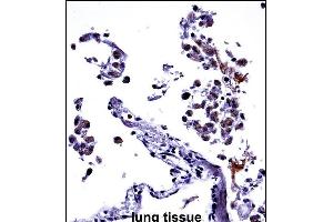 IL13 Antibody (C-term) ((ABIN657659 and ABIN2846653))immunohistochemistry analysis in formalin fixed and paraffin embedded human lung tissue followed by peroxidase conjugation of the secondary antibody and DAB staining. (IL-13 antibody  (C-Term))