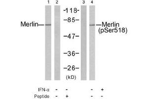 Image no. 2 for anti-Neurofibromin 2 (NF2) (pSer518) antibody (ABIN197028) (Merlin antibody  (pSer518))