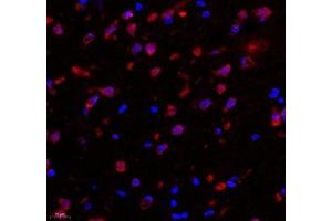 Immunofluorescence of paraffin embedded rat substantia nigra using C1orf173 (ABIN7074073) at dilution of 1: 650 (400x lens) (Glutamate-Rich Protein 3 (ERICH3) antibody)