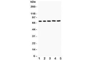 Western blot testing of RIP1 antibody and Lane 1:  Jurkat;  2: 22RV1;  3: MCF-7;  4: HeLa;  5: A549. (RIPK1 antibody  (AA 316-671))