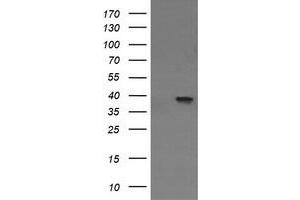 Image no. 1 for anti-Mitogen-Activated Protein Kinase Kinase 3 (MAP2K3) antibody (ABIN1499415) (MAP2K3 antibody)