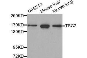 Western Blotting (WB) image for anti-Tuberous Sclerosis 2 (TSC2) antibody (ABIN5663676) (Tuberin antibody)