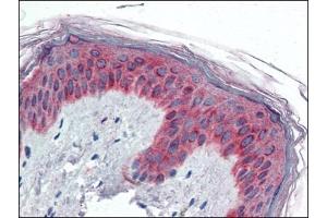 Human Skin (formalin-fixed, paraffin-embedded) stained with VAV3at 5 µg/ml followed by biotinylated anti-goat IgG secondary antibody, alkaline phosphatase-streptavidin and chromogen. (VAV3 antibody  (Internal Region))