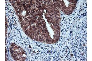 Image no. 1 for anti-Haloacid Dehalogenase-Like Hydrolase Domain Containing 1 (HDHD1) antibody (ABIN1498625) (HDHD1 antibody)