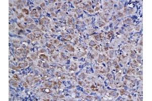 Formalin-fixed and paraffin embedded rat ovary labeled with Anti-Cyclin F Polyclonal Antibody, Unconjugated (ABIN732968) followed by conjugation to the secondary antibody and DAB staining (Cyclin F antibody  (AA 451-550))