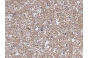 #VALUE! (CRMP1 antibody  (AA 1-250))