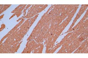 Detection of MBP in Human Cerebrum Tissue using Monoclonal Antibody to Myelin Basic Protein (MBP) (MBP antibody  (AA 220-301))