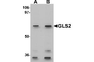 Western blot analysis of GLS2 in rat kidney tissue lysate with GLS2 antibody at (A) 0. (GLS2 antibody  (C-Term))
