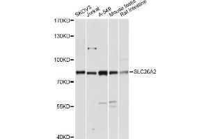 Western blot analysis of extracts of various cell lines, using SLC26A2 antibody. (SLC26A2 antibody)