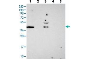Western blot analysis of Lane 1: RT-4, Lane 2: U-251 MG, Lane 3: Human Plasma, Lane 4: Liver, Lane 5: Tonsil with FAM113B polyclonal antibody . (PCED1B antibody)
