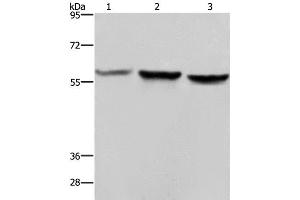 Western Blot analysis of Hela, A375 and LoVo cell using SYN2 Polyclonal Antibody at dilution of 1:1400 (SYN2 antibody)