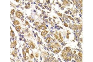 Immunohistochemistry of paraffin-embedded Human stomach using METTL7B Polyclonal Antibody at dilution of 1:100 (40x lens). (METTL7B antibody)