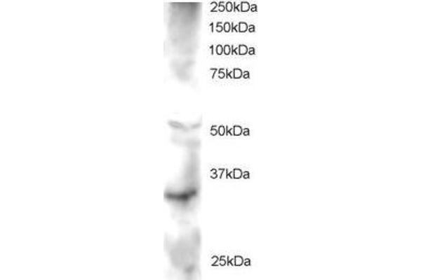 FRAT2 antibody  (C-Term)