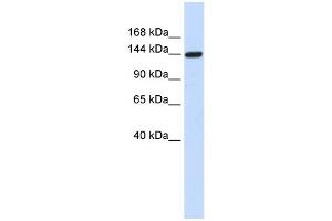 WB Suggested Anti-DAAM1 Antibody Titration: 0. (DAAM1 antibody  (Middle Region))