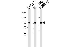 Western blot analysis of lysates from LNCaP cell line , mouse kidney, rat kidney tissue lysate(from left to right), using E Antibody (Center) (ABIN6243089 and ABIN6577479). (MME antibody  (AA 492-525))