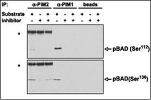 PIM proteins were immunoprecipitated from MV4,11 cells and the agarose-protein A-immunoprecipitate complex was tested for its ability to phosphorylate BAD in vitro in the presence or absence of . (PIM2 antibody  (C-Term))