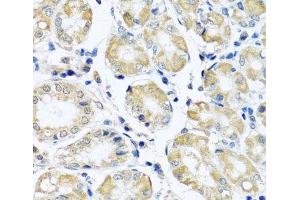 Immunohistochemistry of paraffin-embedded Human stomach using NDUFB10 Polyclonal Antibody at dilution of 1:100 (40x lens). (NDUFB10 antibody)
