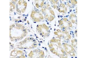 Immunohistochemistry of paraffin-embedded Human stomach using NDUFB10 Polyclonal Antibody at dilution of 1:100 (40x lens).
