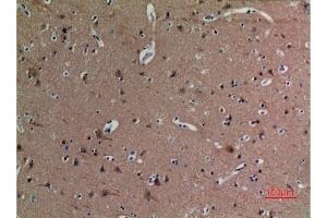 Immunohistochemical analysis of paraffin-embedded human-brain, antibody was diluted at 1:100. (alpha Tubulin antibody  (acLys40))