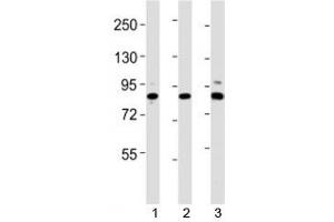 Western blot testing of Suz12 antibody at 1:2000 dilution. (SUZ12 antibody  (AA 381-395))