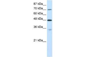 CARS antibody used at 0. (CARS antibody  (C-Term))