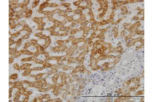Immunoperoxidase of monoclonal antibody to UBE2G2 on formalin-fixed paraffin-embedded human liver. (UBE2G2 antibody  (AA 1-87))