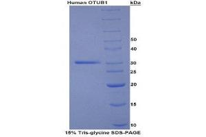 SDS-PAGE (SDS) image for OTU Domain, Ubiquitin Aldehyde Binding 1 (OTUB1) (AA 1-271) protein (His tag) (ABIN1080427)
