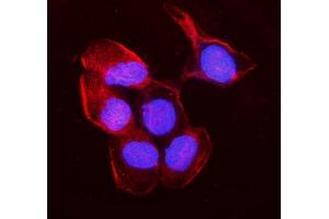 IF analysis of non-muscle Myosin IIB/MYH10 using anti-non-muscle Myosin IIB/MYH10 antibody (ABIN7603186).