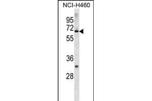 Zinc Finger Protein 185 抗体  (N-Term)