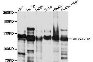 Western blot analysis of extract of various cells, using CACNA2D3 antibody. (CACNA2D3 antibody)