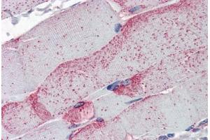 Skeletal muscle (OB Cadherin antibody  (Intracellular))