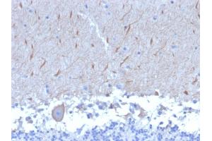 Formalin-fixed, paraffin-embedded human Brain stained with ATG5 Mouse Monoclonal Antibody (ATG5/2553). (ATG5 antibody  (AA 1-119))