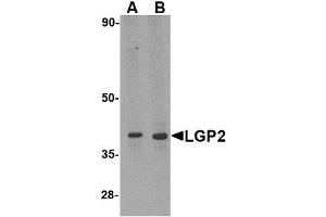 Image no. 1 for anti-DEXH (Asp-Glu-X-His) Box Polypeptide 58 (DHX58) (N-Term) antibody (ABIN1494350) (DHX58 antibody  (N-Term))