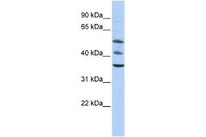 WB Suggested Anti-TRIM68 Antibody Titration:  0.
