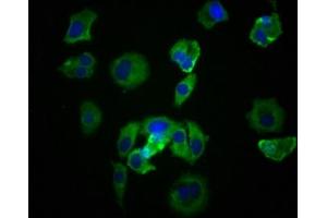 Immunofluorescence staining of MCF-7 cells with ABIN7127824 at 1:39, counter-stained with DAPI. (Recombinant Src antibody)