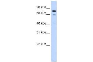 RMI1 antibody used at 1 ug/ml to detect target protein. (RMI1 antibody)