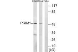 Western blot analysis of extracts from COLO/HeLa cells, using PRIM1 Antibody. (PRIM1 antibody  (AA 371-420))